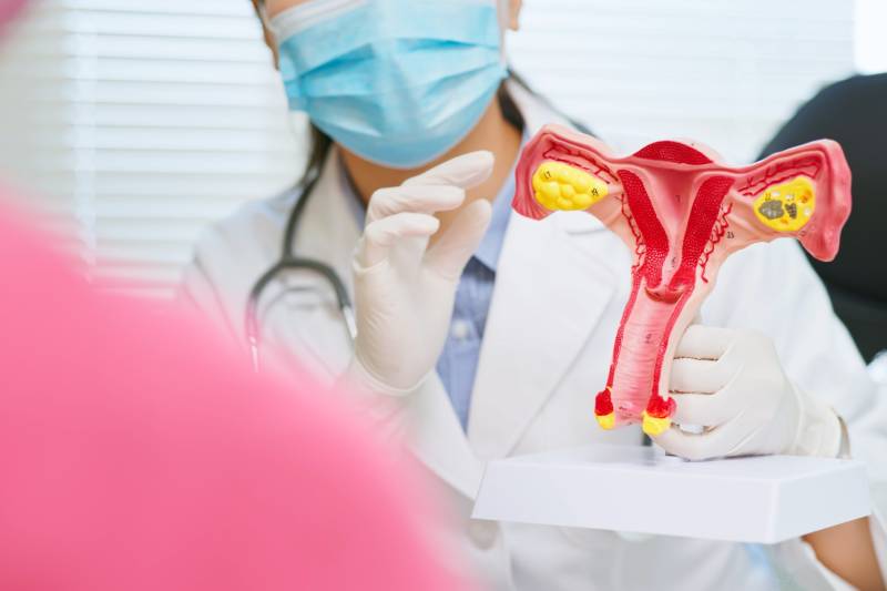 A female doctor holding a uterus model explaining about cervical cancer to woman sitting in front of her.