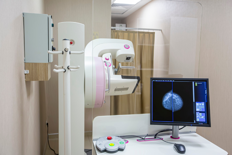 Mammography device inside an imaging room with a test result displayed on the monitor.