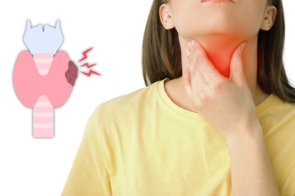 Close up view of a woman holding her throat in pain and a diagram of an underactive thyroid with an unusual/painful growth on one side. 