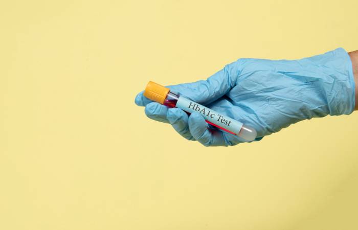 A hand wearing a glove holding a blood sample for HbA1c test.