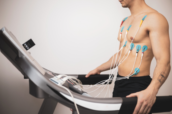 A young man undergoing a TMT/stress test on a treadmill with leads placed all over his upper body.
