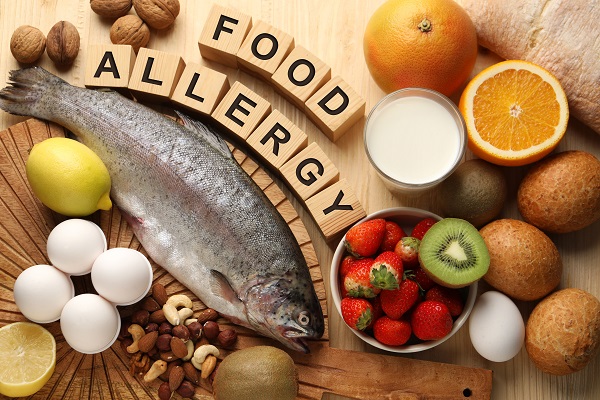 Blocks of food allergens, such as fruits,vegetables, nuts, dairy products, and fish, displayed on a table.