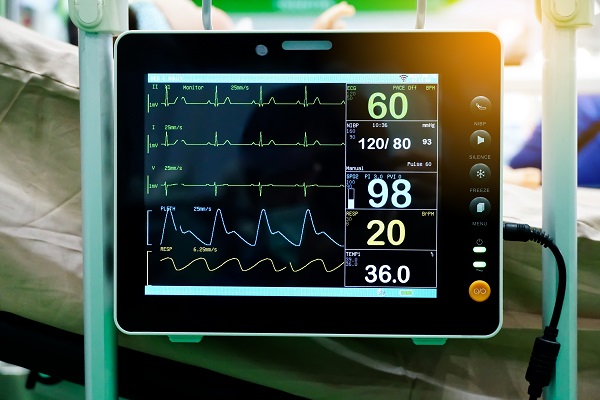 Close-up of a medical monitor showing an ECG test, tracking heart function and detecting heart attack signs.