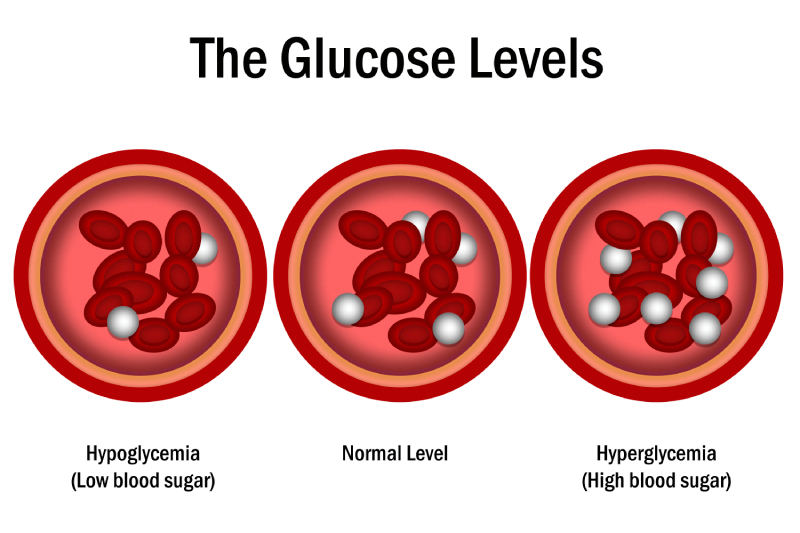 Glucose levels in a blood vessel show normal, hyperglycemia, and hypoglycemia, emphasizing the importance of diabetes management.