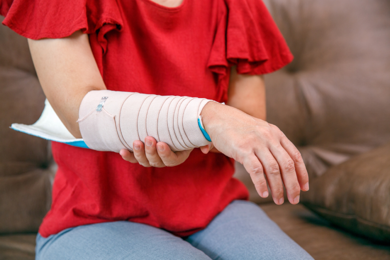An elastic bandage holds a splint on a woman's hand, treating osteoporosis due to calcium deficiency.