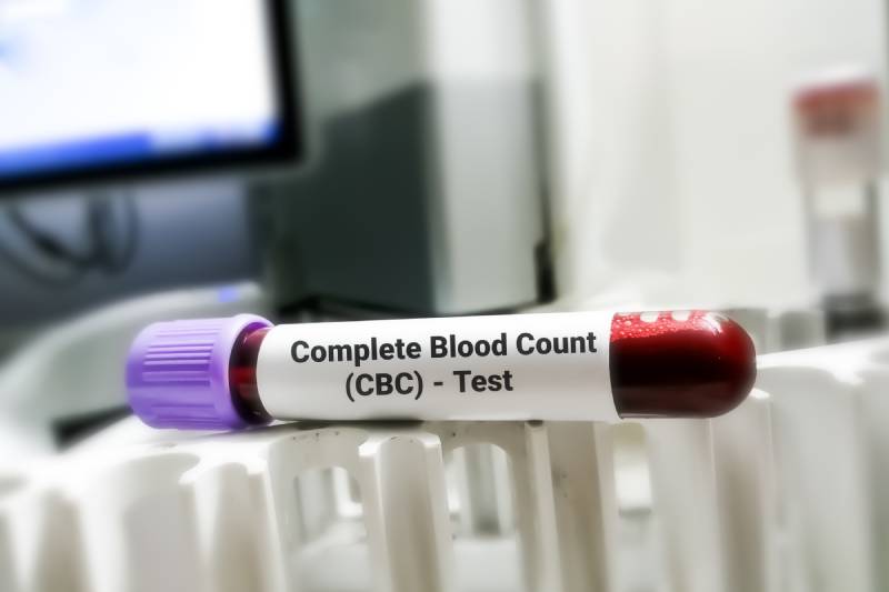 CBC test tube with blood on a lab rack, behind a computer monitor, representing a routine blood test.