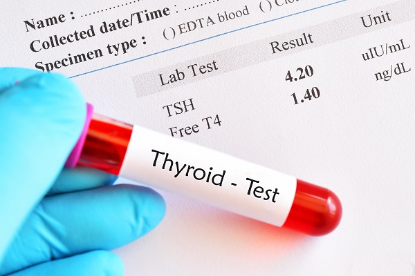 Thyroid report with a blood sample in a test tube, representing a thyroid function test.