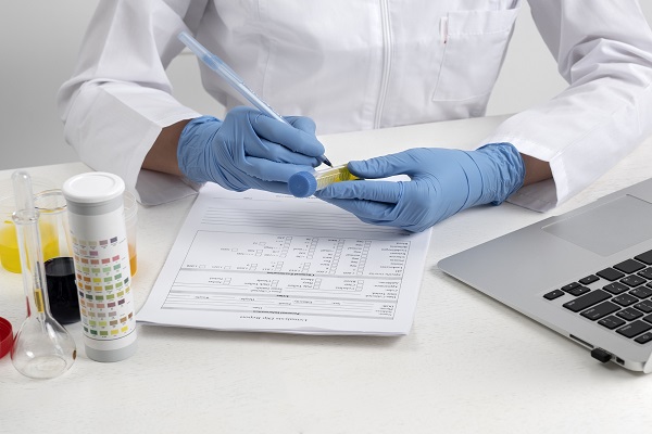 A lab professional marking a test tube near a form and laptop, indicating a kidney function test.