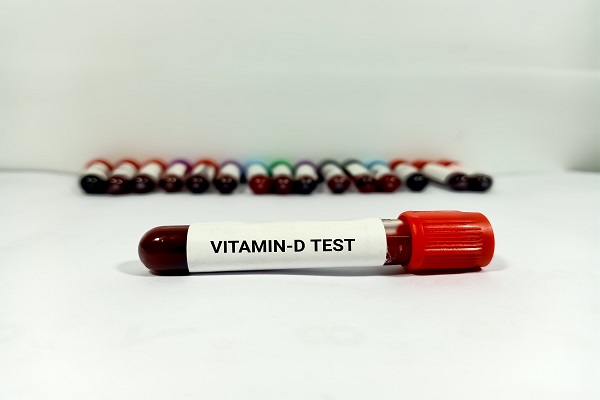 A 'VITAMIN-D TEST' tube held before test tubes, highlighting vitamin D testing's importance for women.