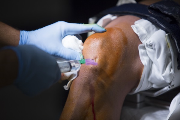 A medical professional administering a knee injection to relieve arthritis pain as a non-surgical treatment.
