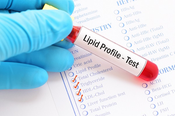 Blood test tube labeled 'Lipid Profile - Test' on a medical form, used to assess coronary disease risk and cholesterol levels.
